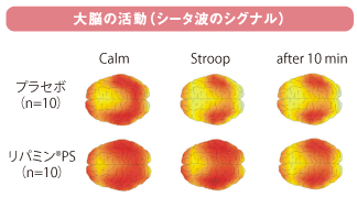 大脳の活動